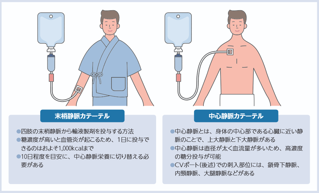末梢静脈カテーテルと中心静脈カテーテルの違い