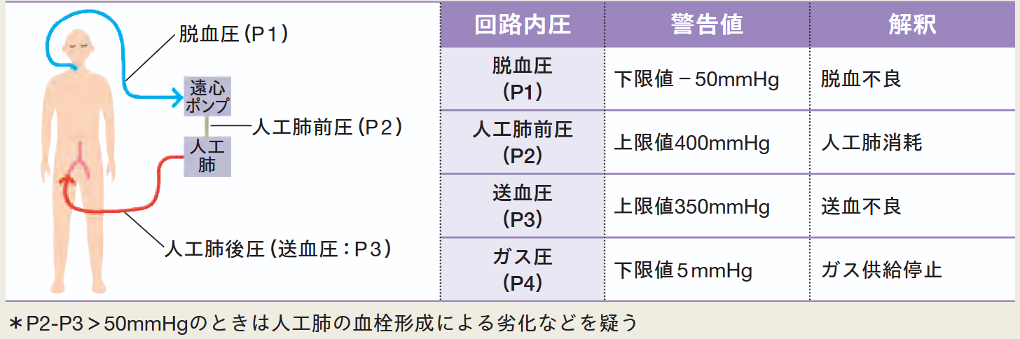 回路内圧の藻にg田リングの図