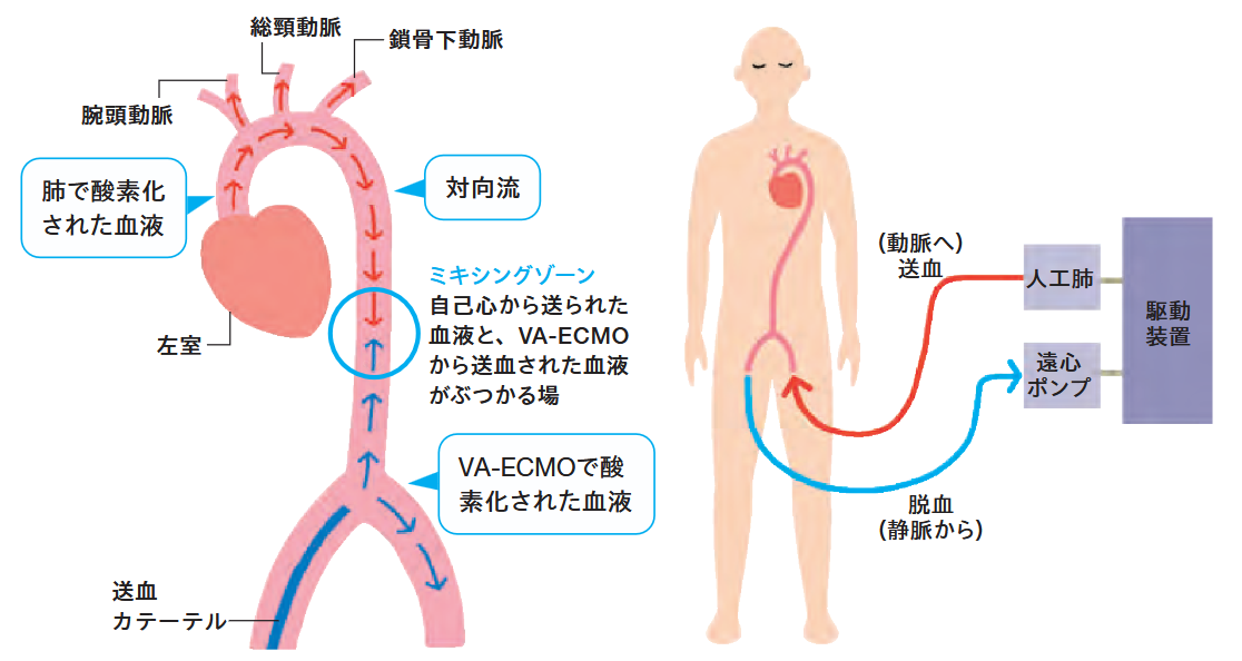 VA-ECMOのしくみの解説図