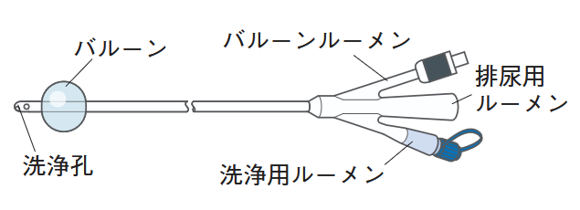 尿道カテーテル〈3way〉の図