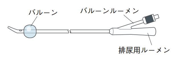 尿道カテーテル〈特殊なカテーテル：チーマン型〉